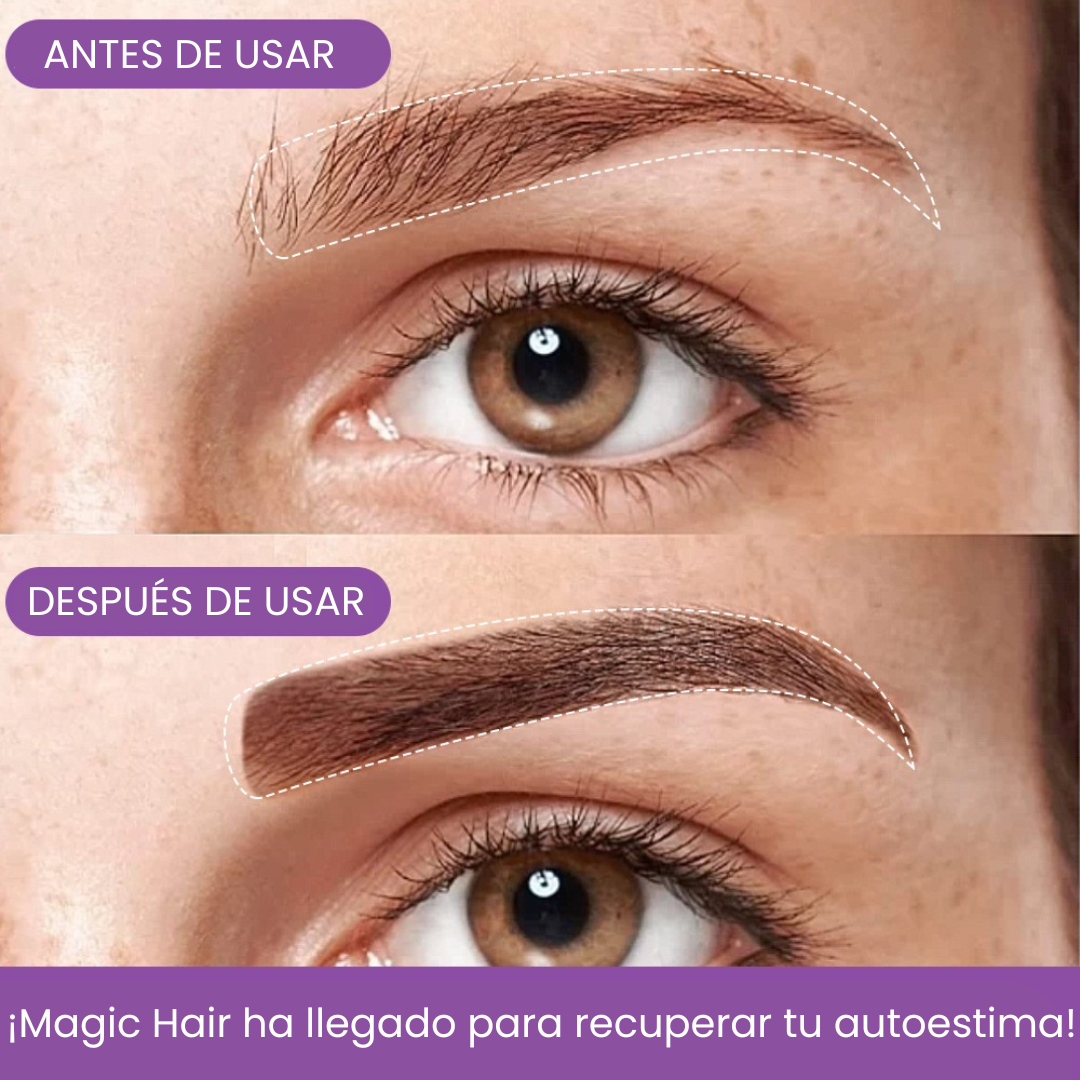 Bunee Corrector de Cabello - Elimina Todas las Canas y Raíces en Segundos