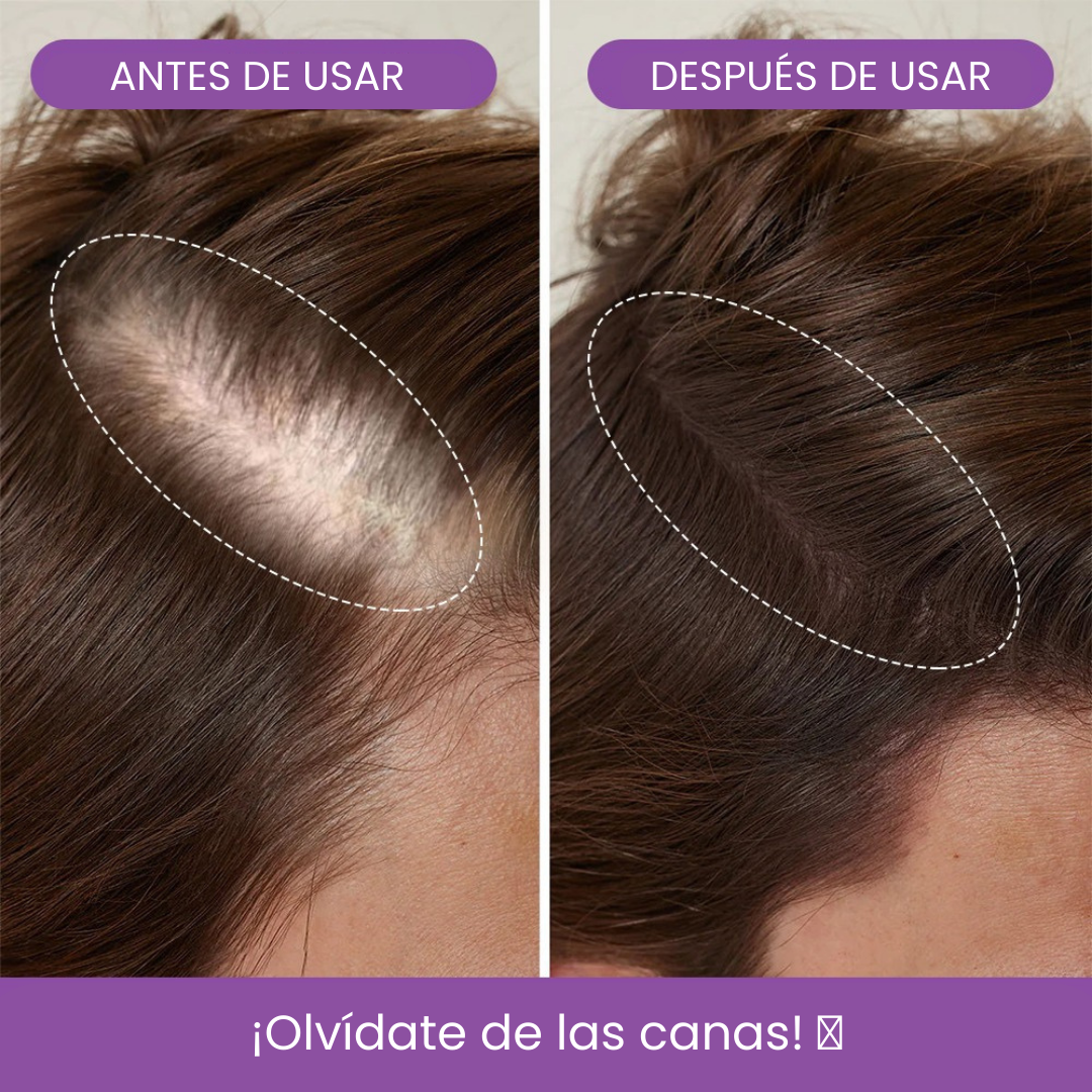 Bunee Corrector de Cabello - Elimina Todas las Canas y Raíces en Segundos