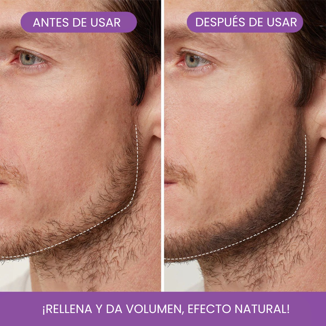Bunee Corrector de Cabello - Elimina Todas las Canas y Raíces en Segundos