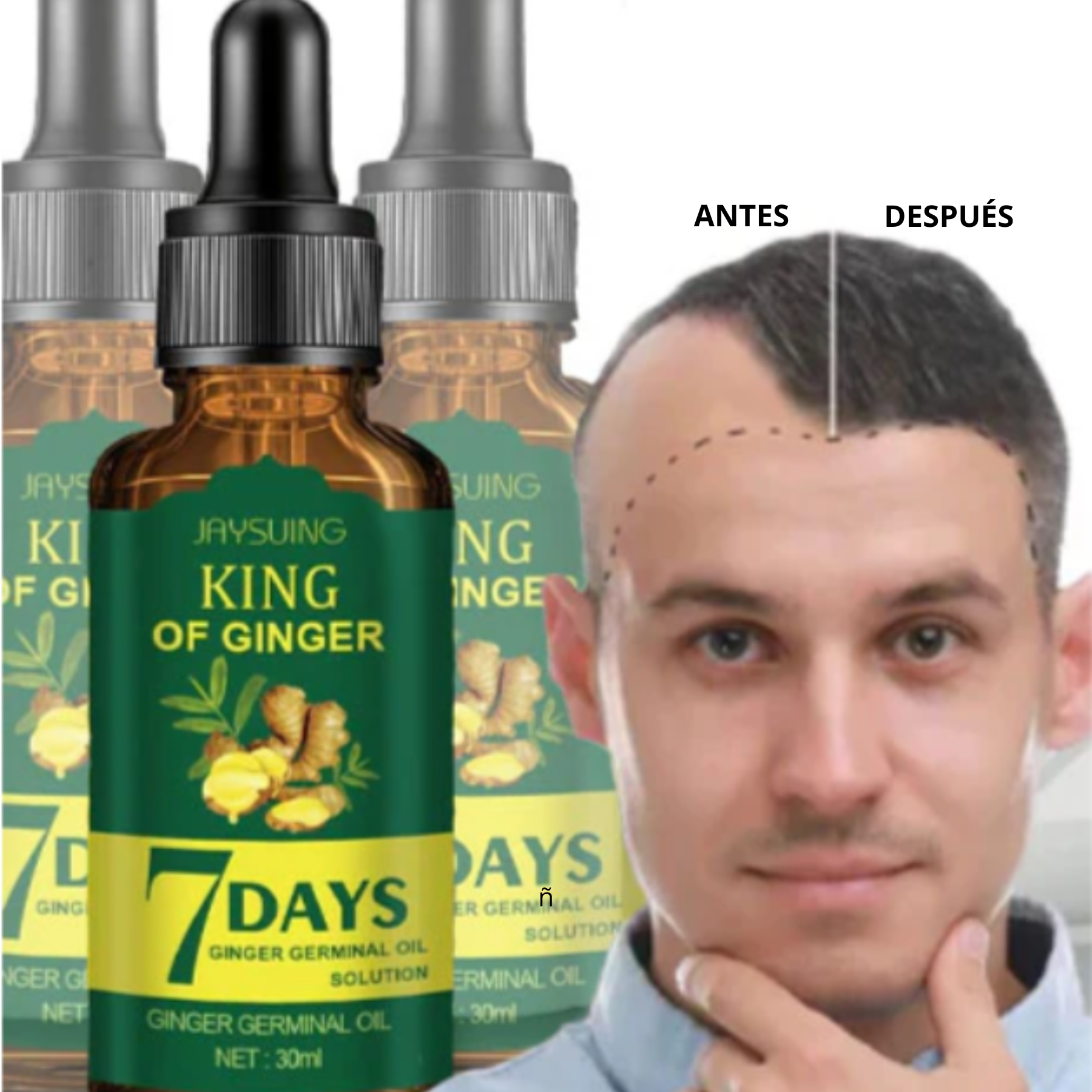 King Of Ginger® Spray Tónico Capilar para Crecimiento en 7 Días- Para Hombres y Mujeres (Pague 2 y Lleva 3)