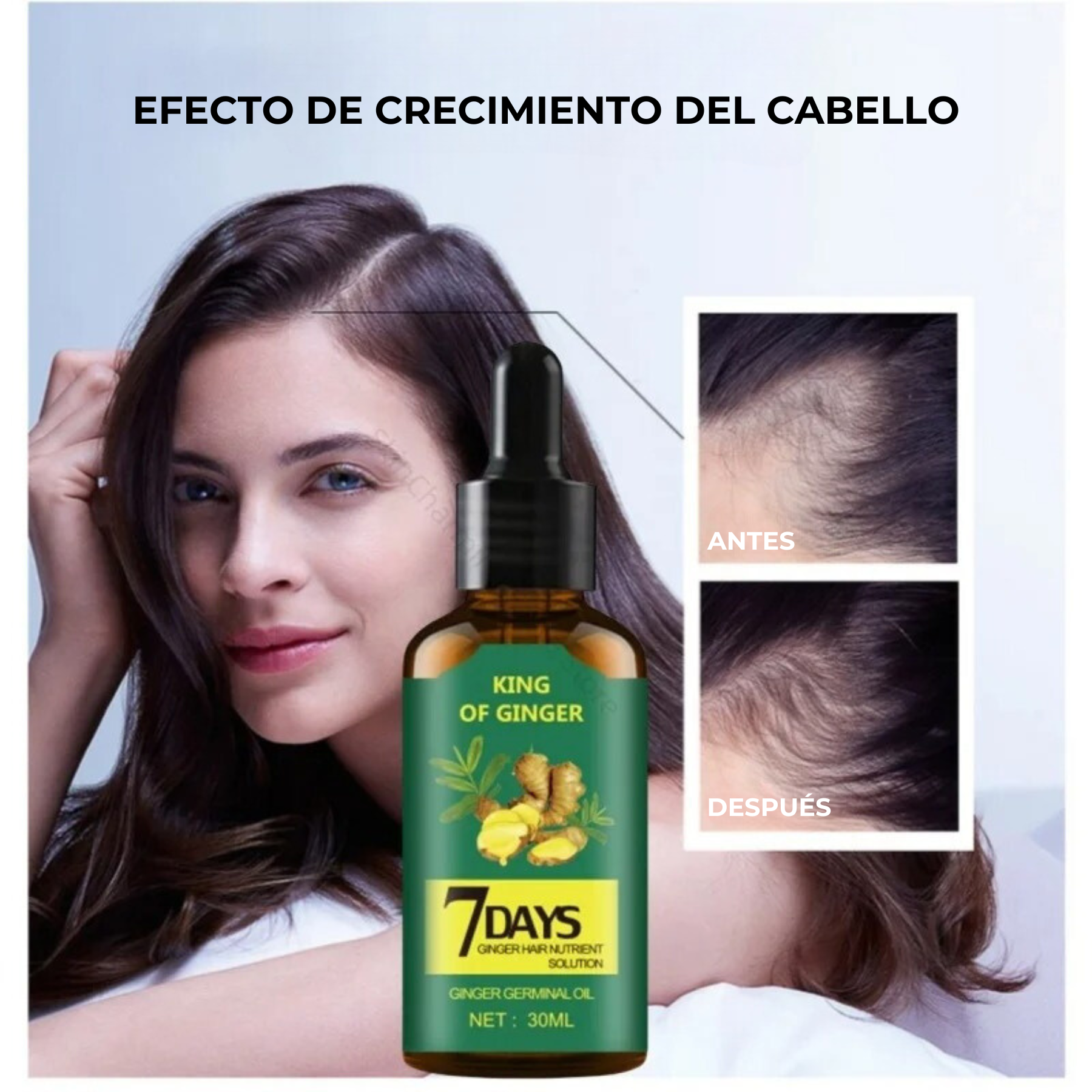 King Of Ginger® Spray Tónico Capilar para Crecimiento en 7 Días- Para Hombres y Mujeres (Pague 2 y Lleva 3)