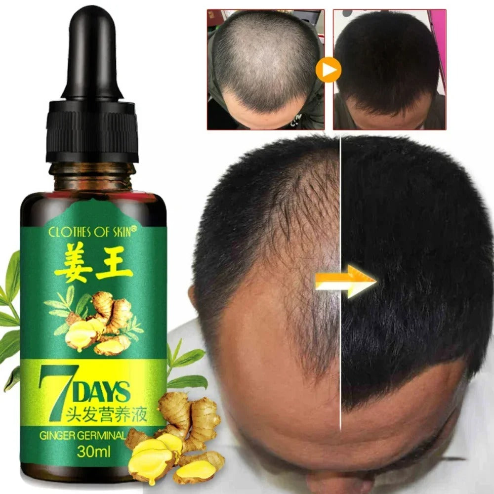 King Of Ginger® Spray Tónico Capilar para Crecimiento en 7 Días- Para Hombres y Mujeres (Pague 2 y Lleva 3)