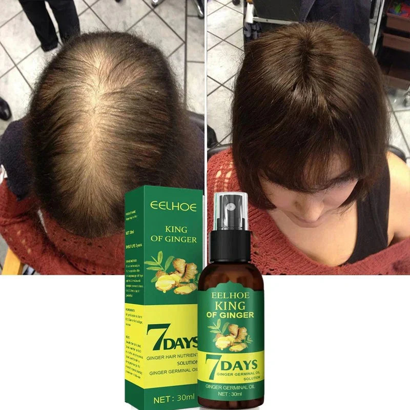 King Of Ginger® Spray Tónico Capilar para Crecimiento en 7 Días- Para Hombres y Mujeres (Pague 2 y Lleva 3)