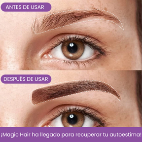 Bunee Corrector de Cabello - Elimina Todas las Canas y Raíces en Segundos