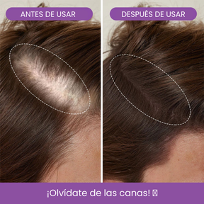 Bunee Corrector de Cabello - Elimina Todas las Canas y Raíces en Segundos