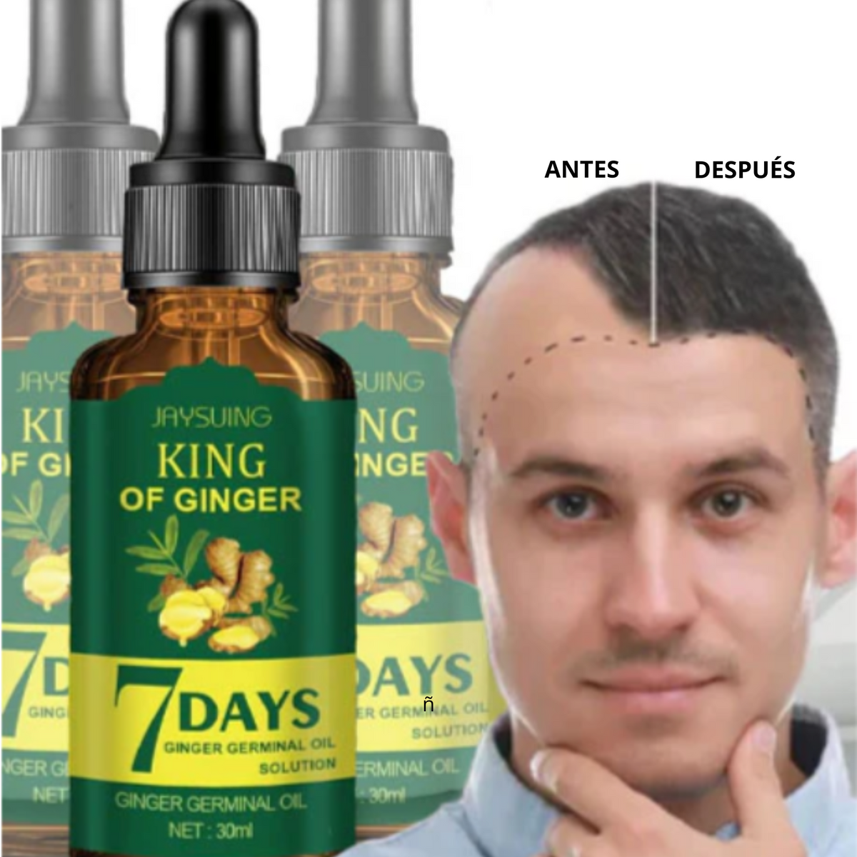 King Of Ginger® Spray Tónico Capilar para Crecimiento en 7 Días- Para Hombres y Mujeres (Pague 2 y Lleva 3)