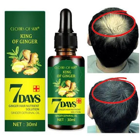 King Of Ginger® Spray Tónico Capilar para Crecimiento en 7 Días- Para Hombres y Mujeres (Pague 2 y Lleva 3)